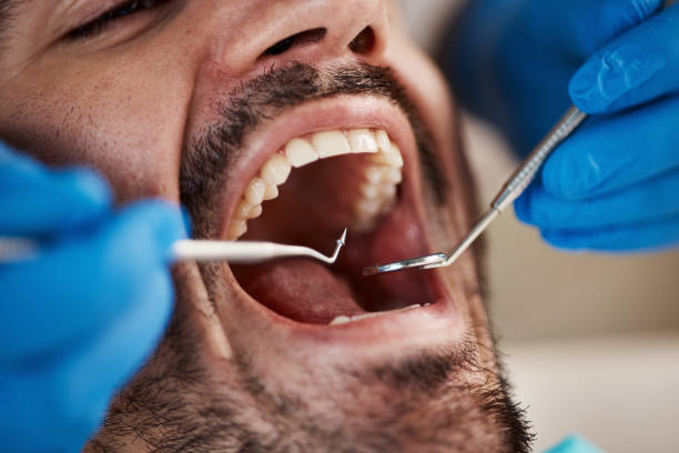 Dental X-Rays and Imaging in Mebane, NC